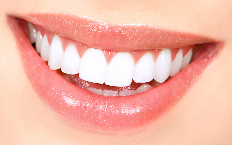 teeth bleaching results